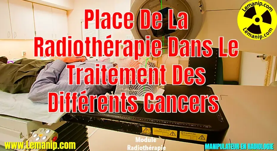 Place De La Radiothérapie Dans Le Traitement Des Différents Cancers