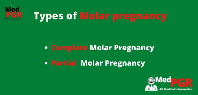Types of  Molar Pregnancy