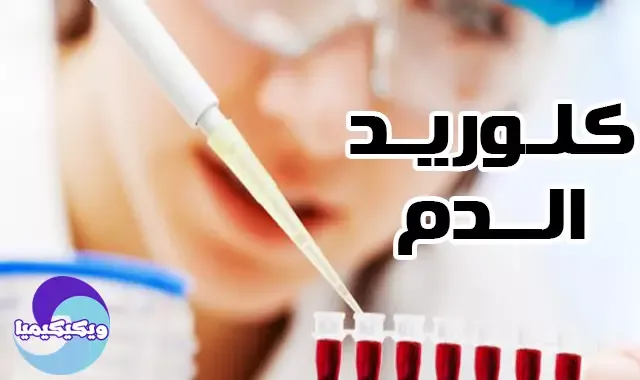 الكلوريد - blood chloride