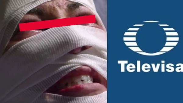 Tras 18 años retirada, Actriz de TV Azteca vuelve a Televisa desfigurada y en la ruina