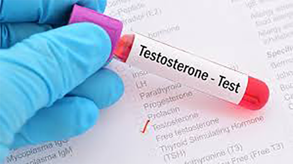 انخفاض هرمون التستوستيرون : 8 أسباب وطرق لزيادة مستوياته