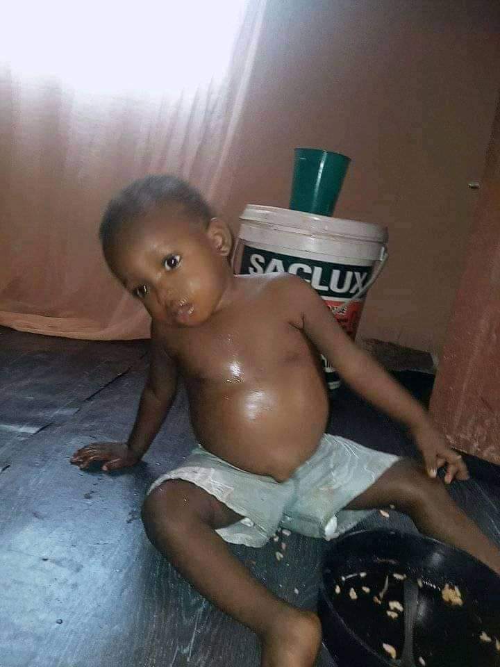 Nigerians react as a boy nearly dies from overfeeding (See pictures)