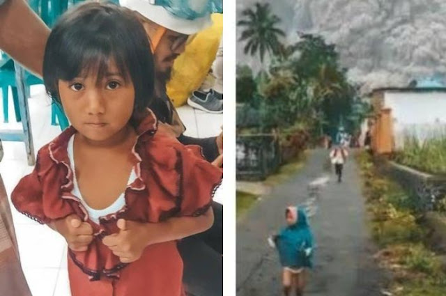 Begini Kondisi Anak Yang Viral Selamatkan Diri Dari Awan Panas Semeru