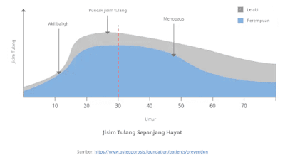 Anlene Ambil Langkah Proaktif Dalam Penjagaan Tulang Sempena Hari Osteoporosis Sedunia
