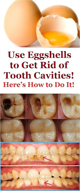 Use Eggshells To Get Rid Of Tooth Cavities! HERE’S HOW TO DO IT!