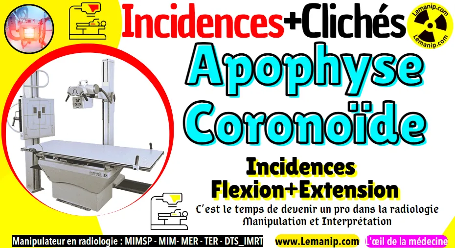 Radio Apophyse coronoïde (Incidences + Clichés)