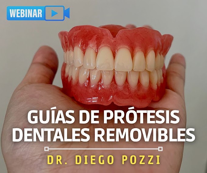 WEBINAR: Guías de Prótesis Dentales Removibles - Dr. Diego Pozzi
