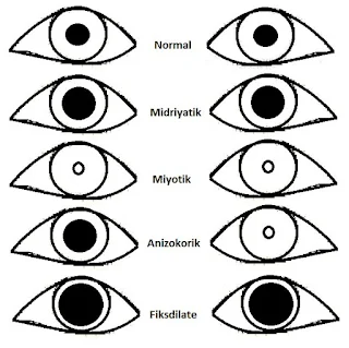 pupil-muayenesi