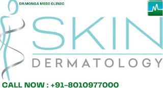 best dermatologist in delhi for hair