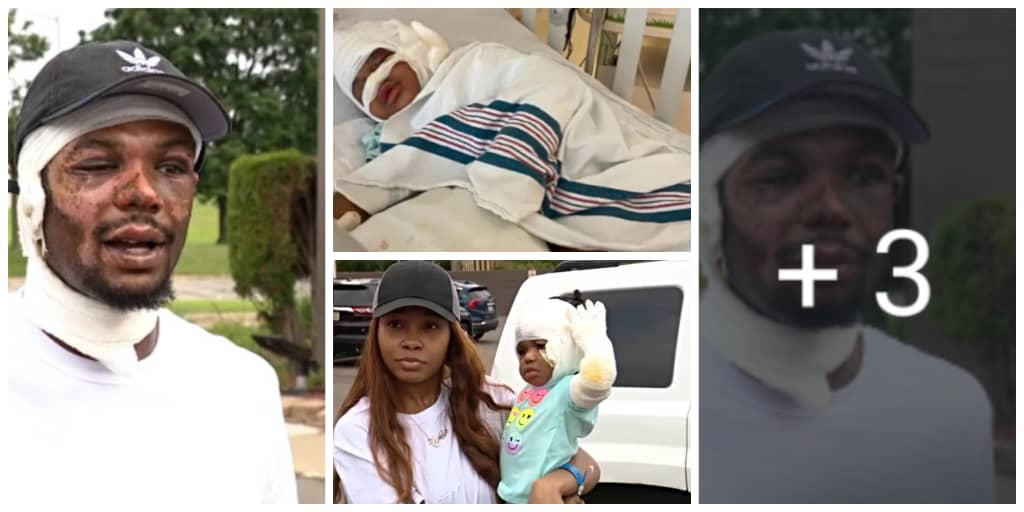 Father Who ran into burning house to save his baby twins gets burned beyond recognition (Photos)