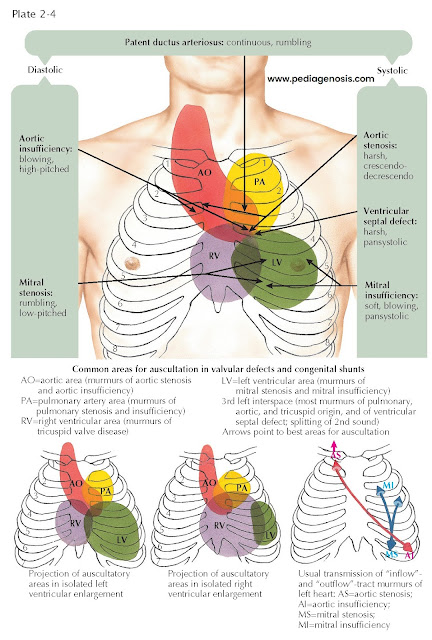 AREAS OF CADIAC AUSCULTATION