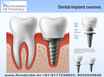 Dental Implant courses in India
