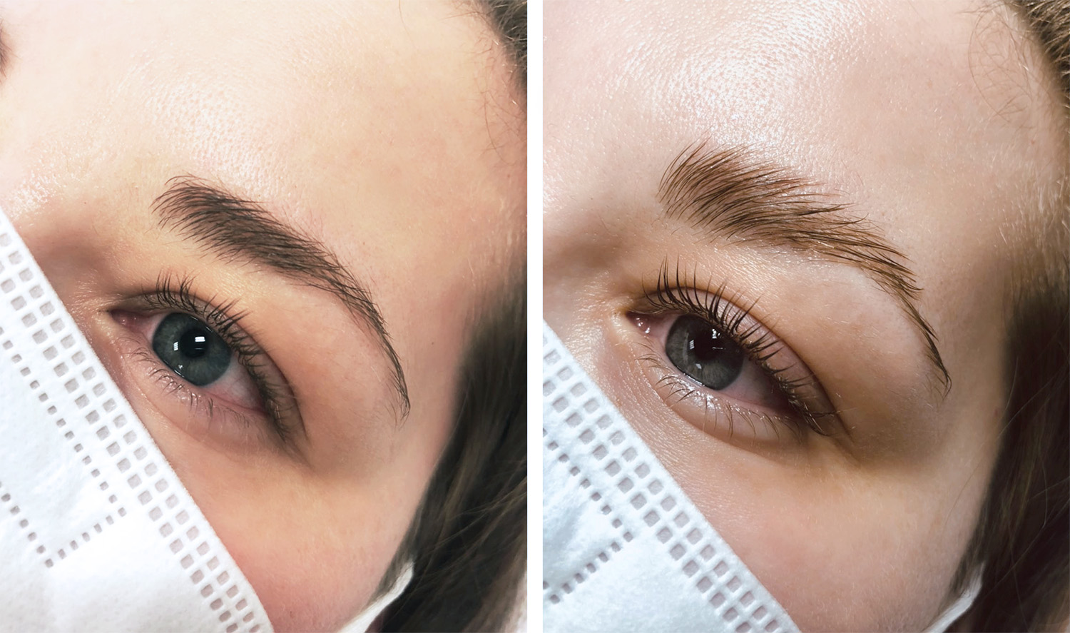 Brow- und Wimpernlifting - Vorher und Nacher