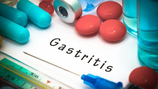 Gastritis predstavlja opšti naziv za grupu oboljenja koja imaju kao zajednički imenitelj zapaljenje sluzokože želuca