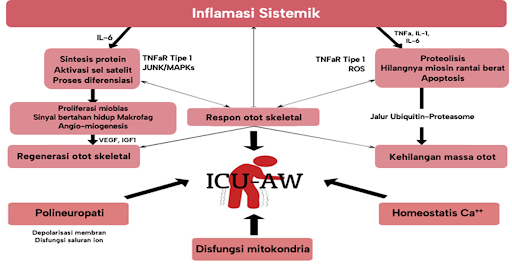 Mekanisme kelemahan yang didapat di ICU.