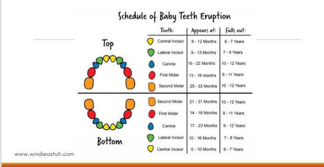 Karies Gigi Pada Anak, Lakukan Pencegahan Sejak Dini
