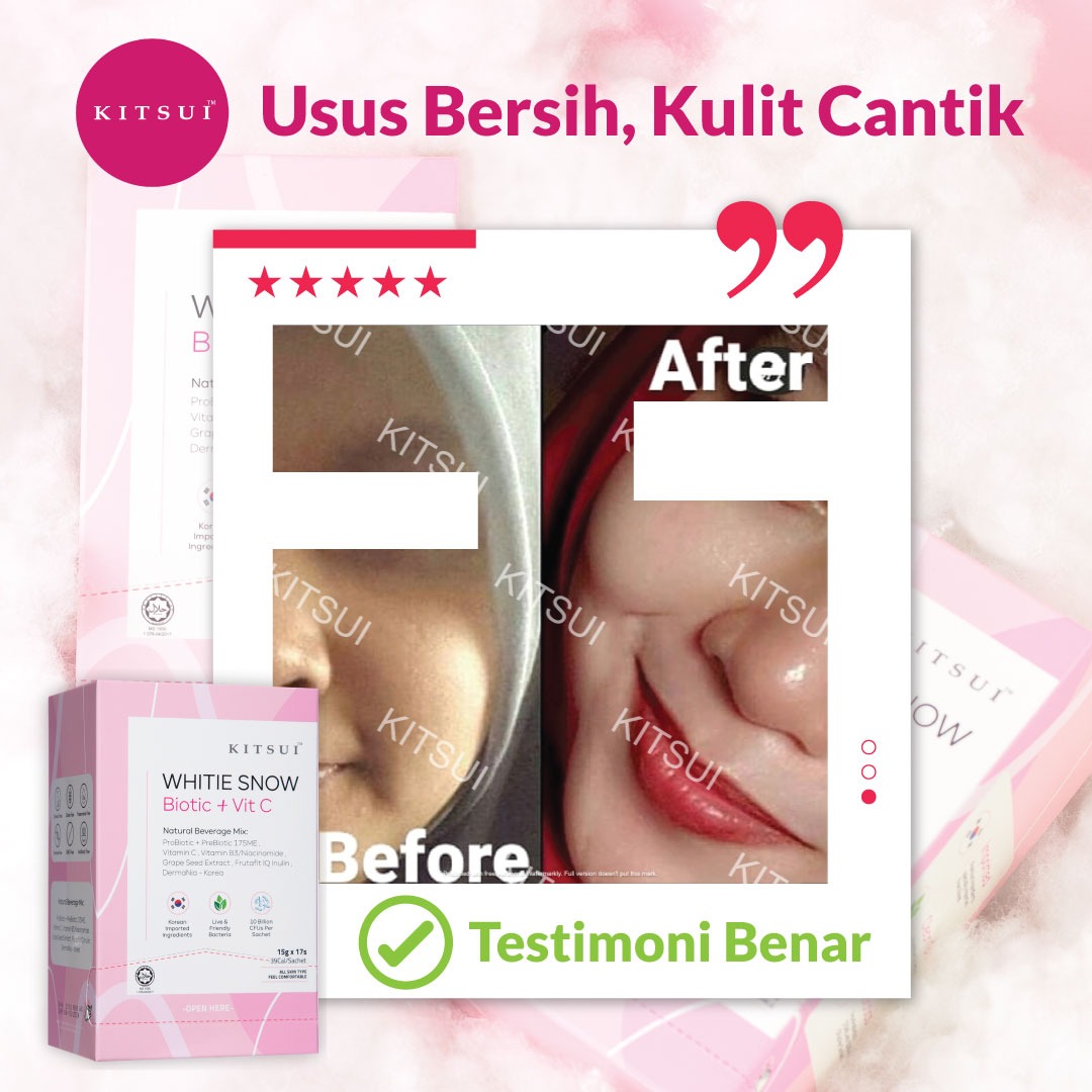 Kitsui Whitie Snow Biotic + Vit C: Kejelitaan Kulit Bermula dari Dalaman