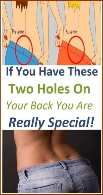 Do You Have These Dimples On Your Lower Back? It Means Something Special