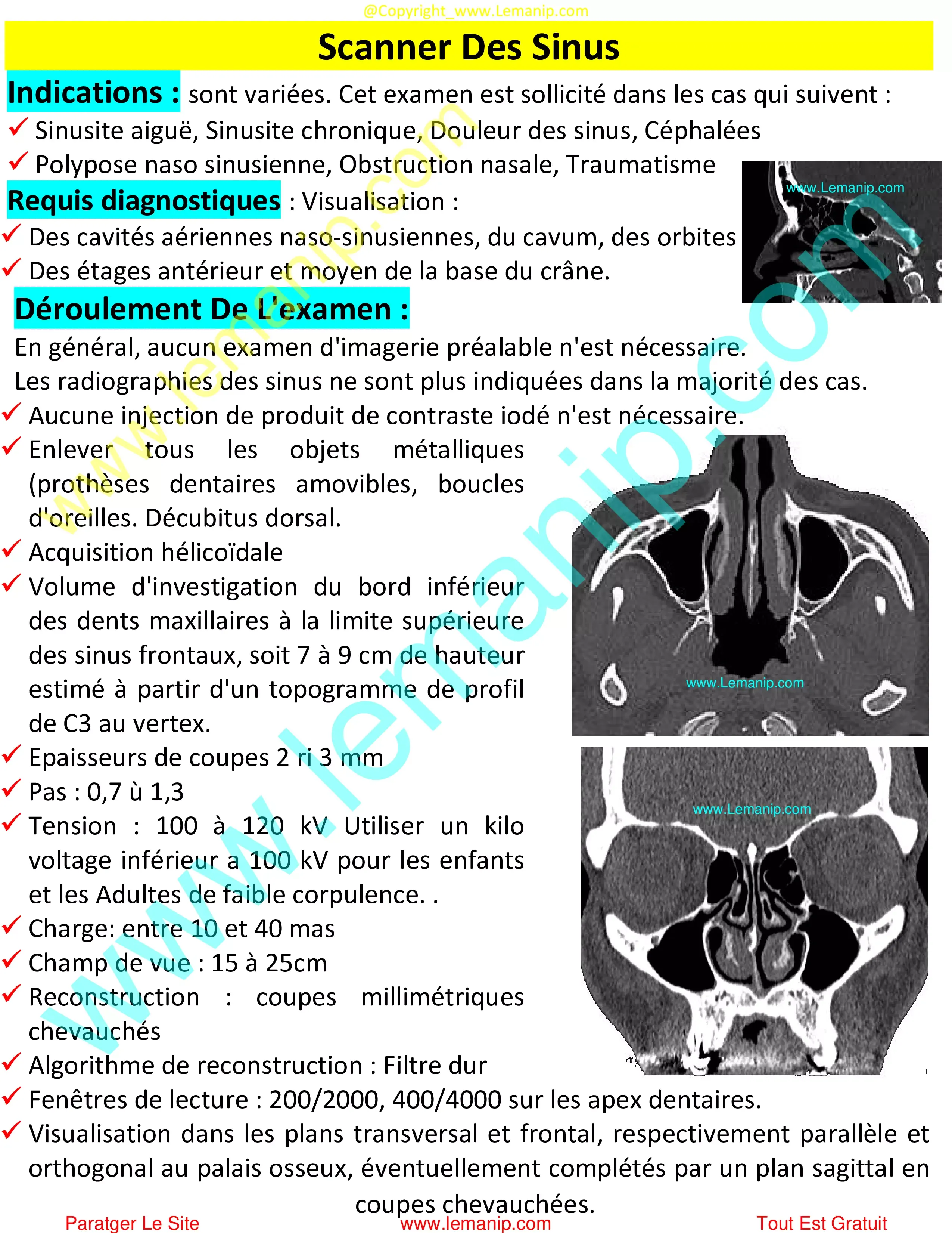 Scanner Des Sinus