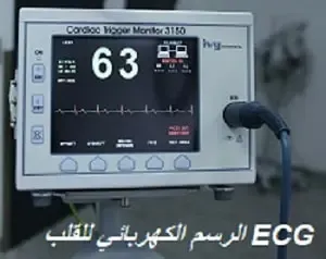 الرسم الكهربائي للقلب ECG