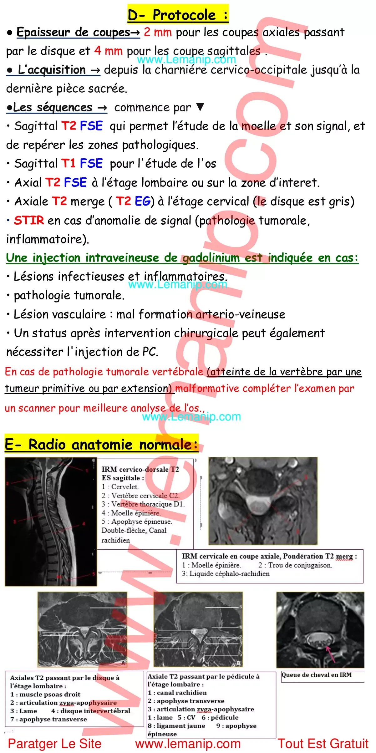 Résumé Cour 1 Du Module Exploration et Sémiologie en IRM 7