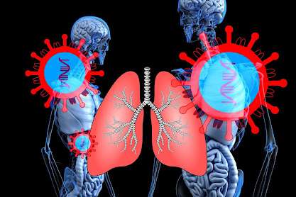 What is Pneumonia and its symptoms