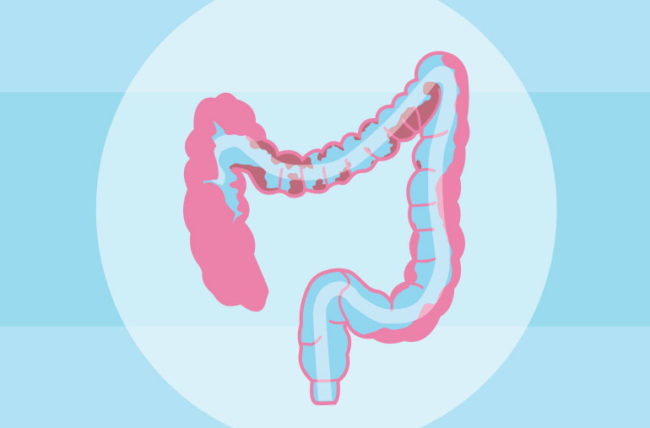 What is a colonic?