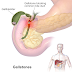 Gallbladder polyps: Symptoms, Diagnosis, and Risks