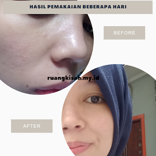 hasil-pemakaian-brightly-ever-after-cream