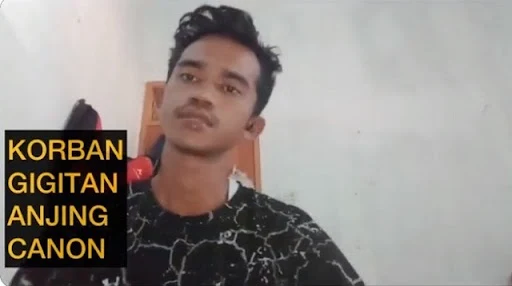 Sejak muncul kesaksian orang yang dilukai anjing Canon sampe masuk RS Testimoni Korban Gigitan Anjing Aceh, Sherina Langsung Terbungkam! Gak Secuil pun Sanggup Kasih Bantahan