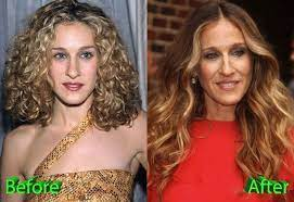 Has Sarah Jessica Parker Undergone Plastic Surgery? Before And After Pictures