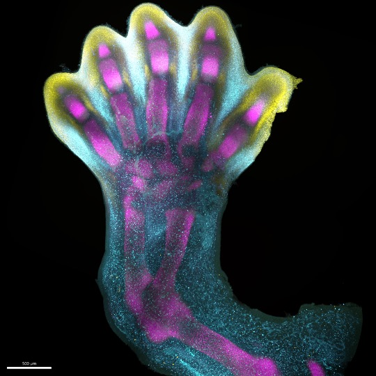 We've Finally Seen in Exquisite Detail How Human Fingers And Toes Grow
