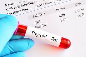 Thyroid blood test packages