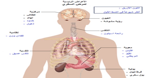 #مرض_السكرى_أنواعه_ودرجاته_وأعراضه_وأسبابه_وعلاجه