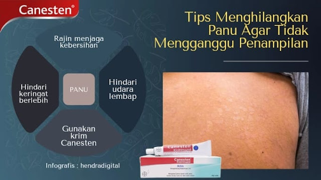 Tips Menghilangkan Panu