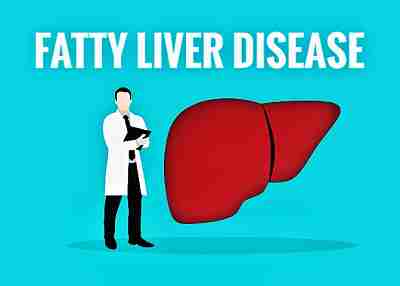Fatty Liver Disease: Causes, Types, Symptoms, Diet and Treatments