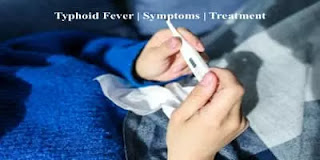 Typhoid Fever