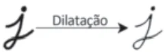 dilatação