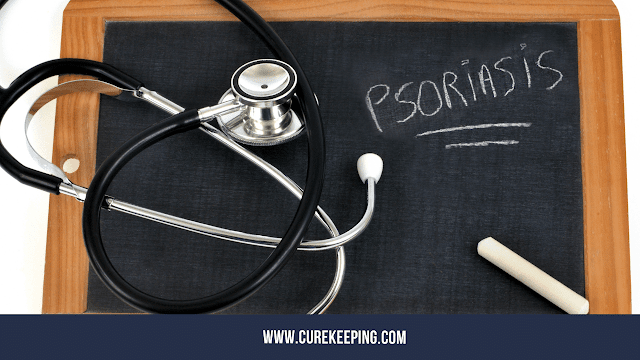 Top 11 Psoriasis Symptoms and Causes