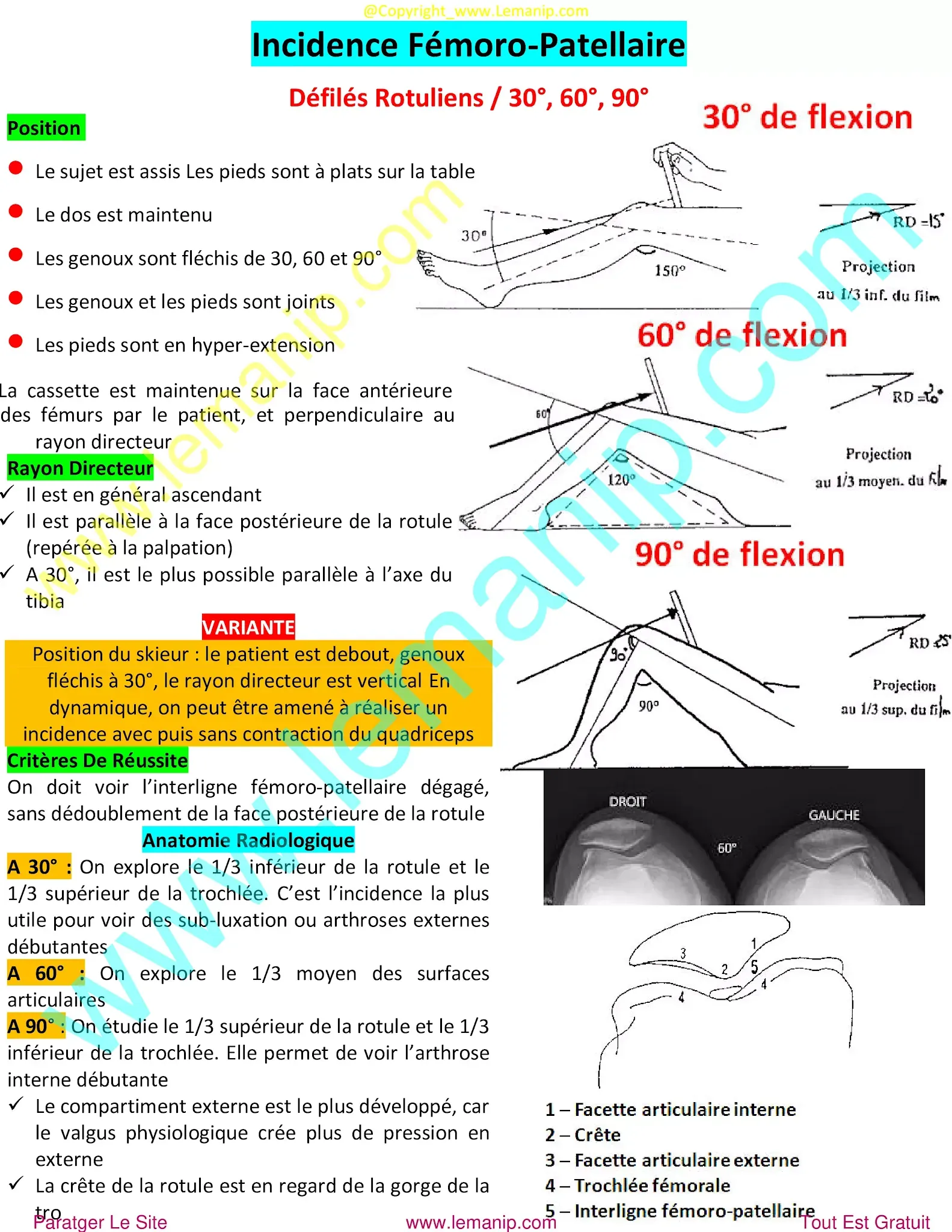 knee doctor,ball joint centre,short femur in fetus,lower ball joint replacement near me,intramedullary femur,femur pain after hip replacement,broken femur during hip replacement,medial patellofemoral ligament,mid thigh pain after hip replacement,knee dr