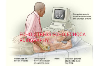 Echocardiography Test in Delhi