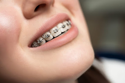 orthodontics in Bristol, CT