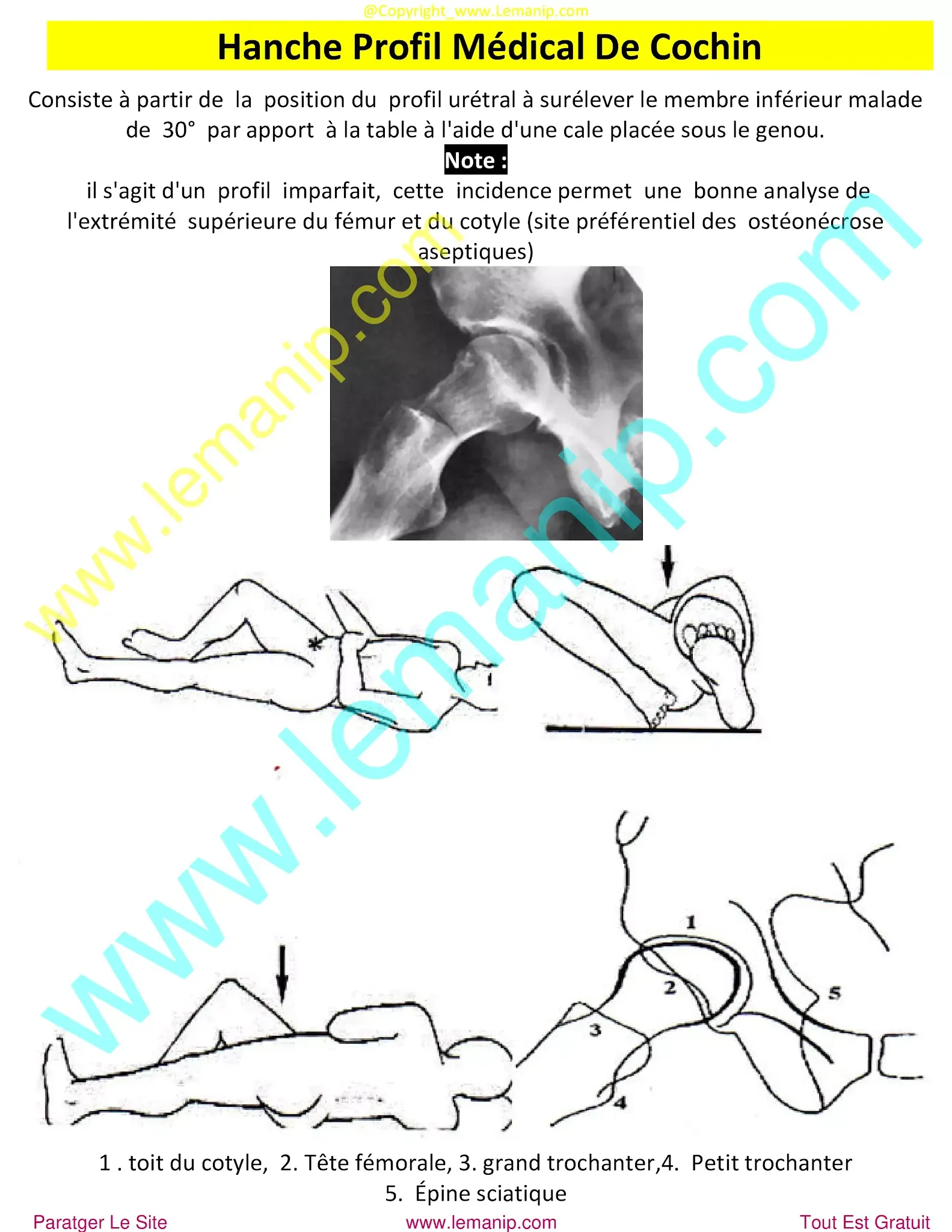 sacrococcygeal joint,pvns,pelvic floor mri,popping hip joint,posterior hip replacement,hip ligaments,rheumatoid,chirurgie hanche clinique privée,douleur hanche et cuisse,chirurgie hanche