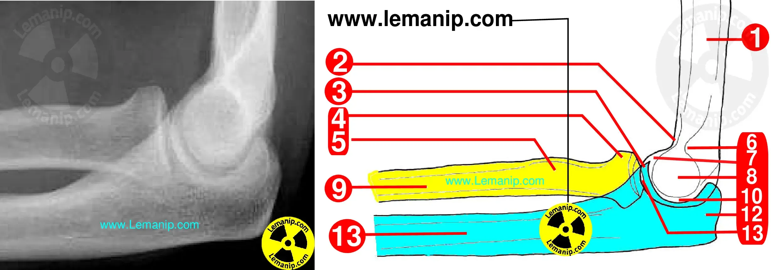 elbow pain orthopedic doctor,hand and elbow doctor near me,elbow pain treatment near me,orthopedic arm doctor near me,hss elbow surgeon,tennis elbow surgeons near me,doctor for elbow pain near me,orthopedic arm doctor,orthopedic for elbow pain,hand wrist and elbow specialists near me