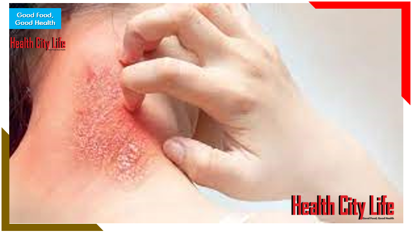 Find out the easy way to get rid of itching, home remedies for itching problem