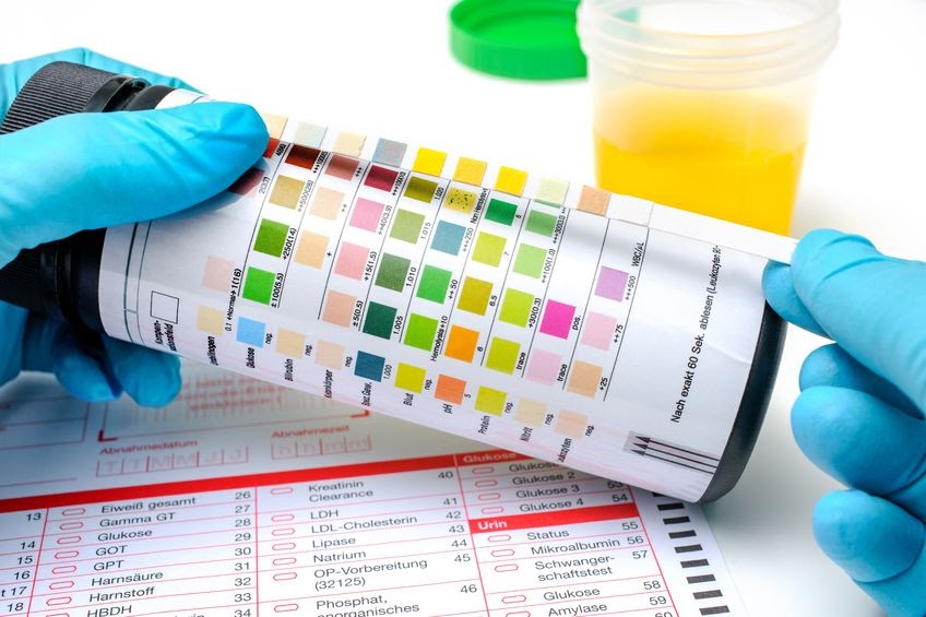 What to Expect from an Alcohol ETG Test Strips & How to Use Them?