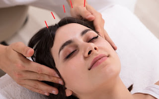 Suatu Primer perihal Akupunktur Klinis