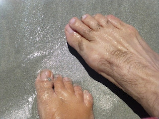 浮き指になった男性の足指の写真