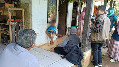 Biadab, Anak Penyandang Disabilitas di Sukabumi Disiksa, 7 Kukunya Dicabut Bibirnya Disundut Rokok