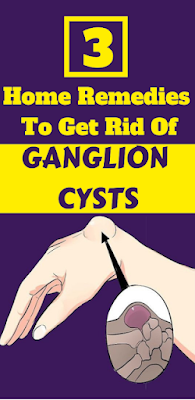 The Best 3 Home Remedies To Get Rid Of Ganglion Cysts